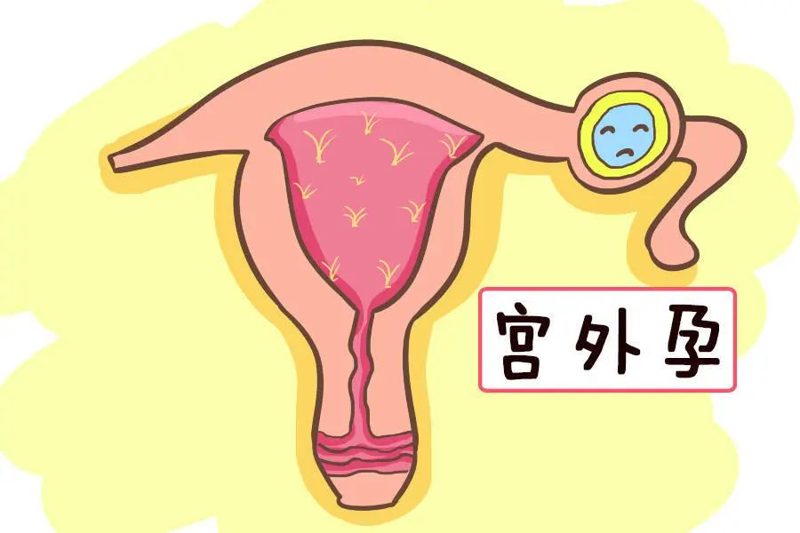 640 (7).png 640 (7).png