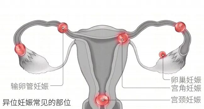 640.png 640.png